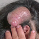 Image for article titled Bada Bing, Dr. Pimple Popper Meets Bada Boob